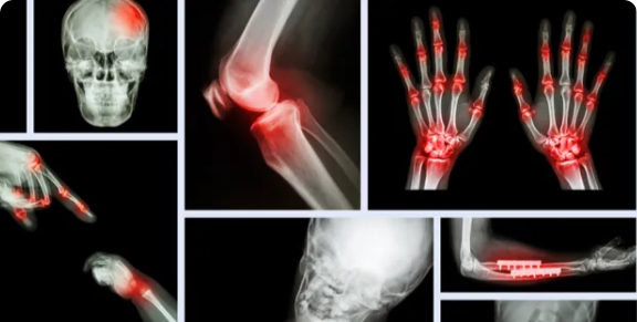 Medical Object Classification